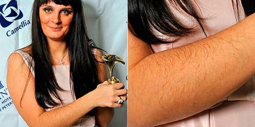 Why do women dream about hairy arms?